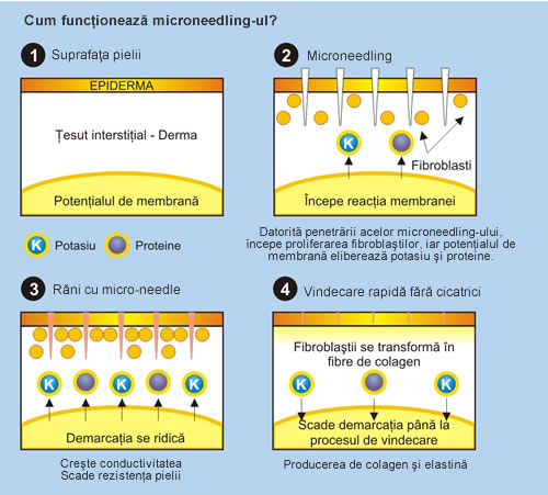 Terapia cu microace