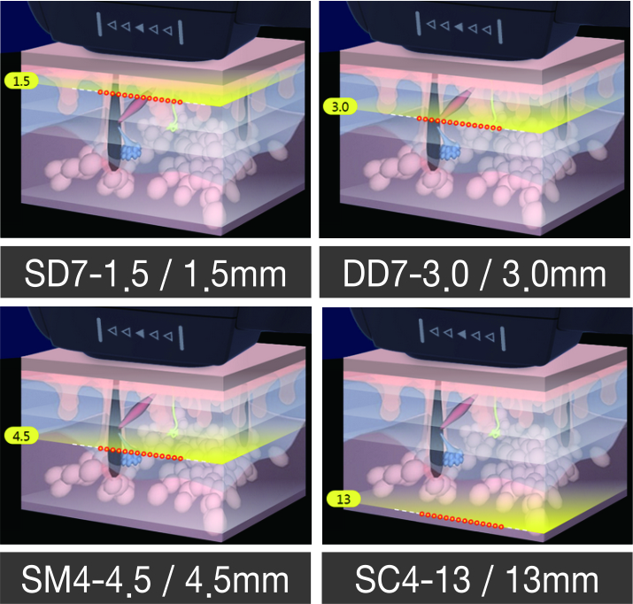 Transducer